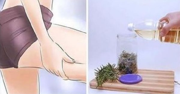 ¿Quieres deshacerte de las várices y la celulitis? No busques más… ¡Aquí está lo que necesitas: Alcohol de romero!